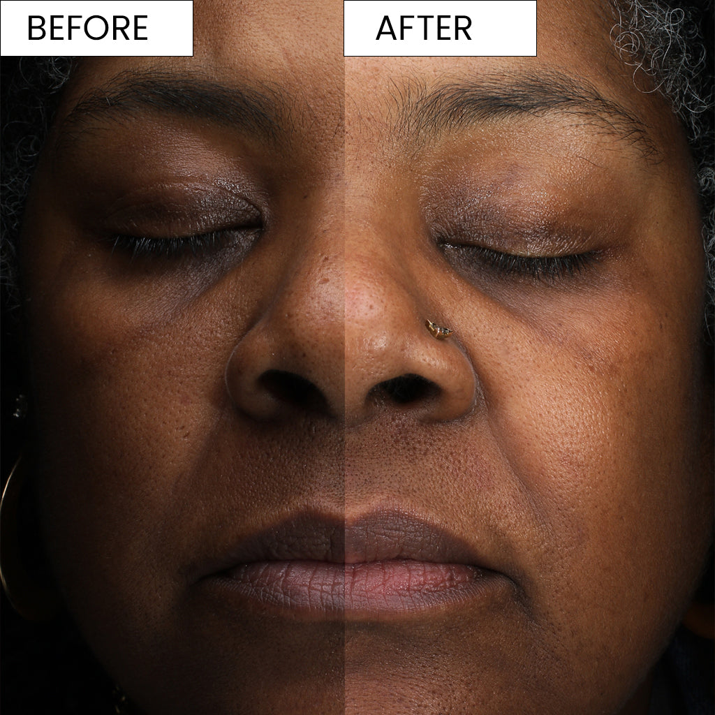 iknow-best-black-owned-skincare-beauty-products-before-and-after-results